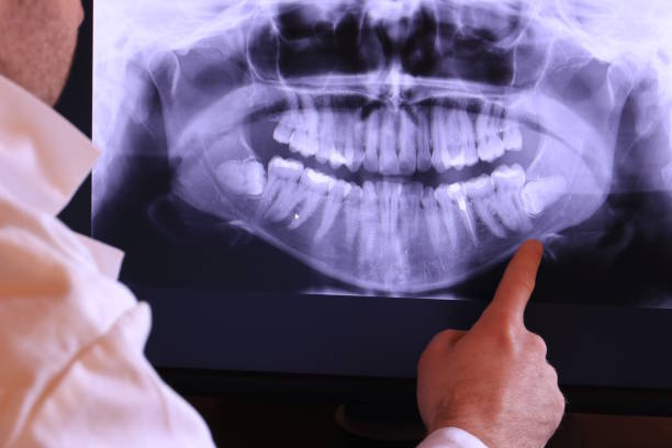 Best Emergency Treatment for Toothache in Savannah, TX
